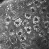 Young-skin-cells